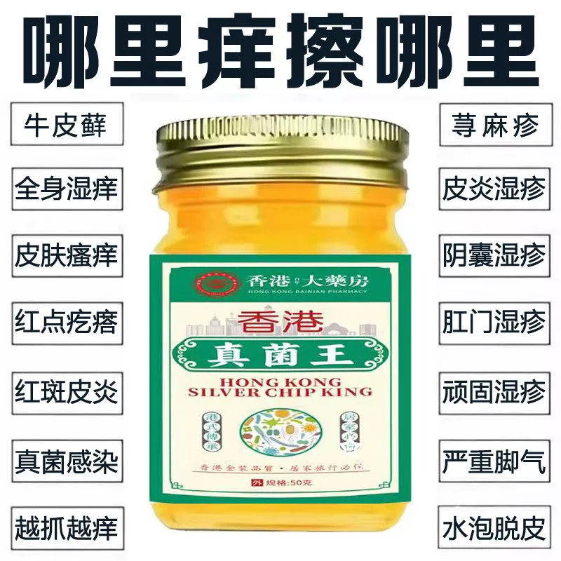香港真菌王止痒真菌感染脚气护理