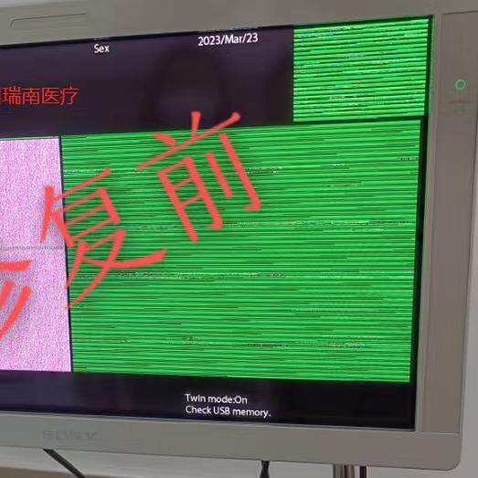 奥林巴斯电子肠镜胃镜导光插头进水镜体内部进水图像模糊修复案例