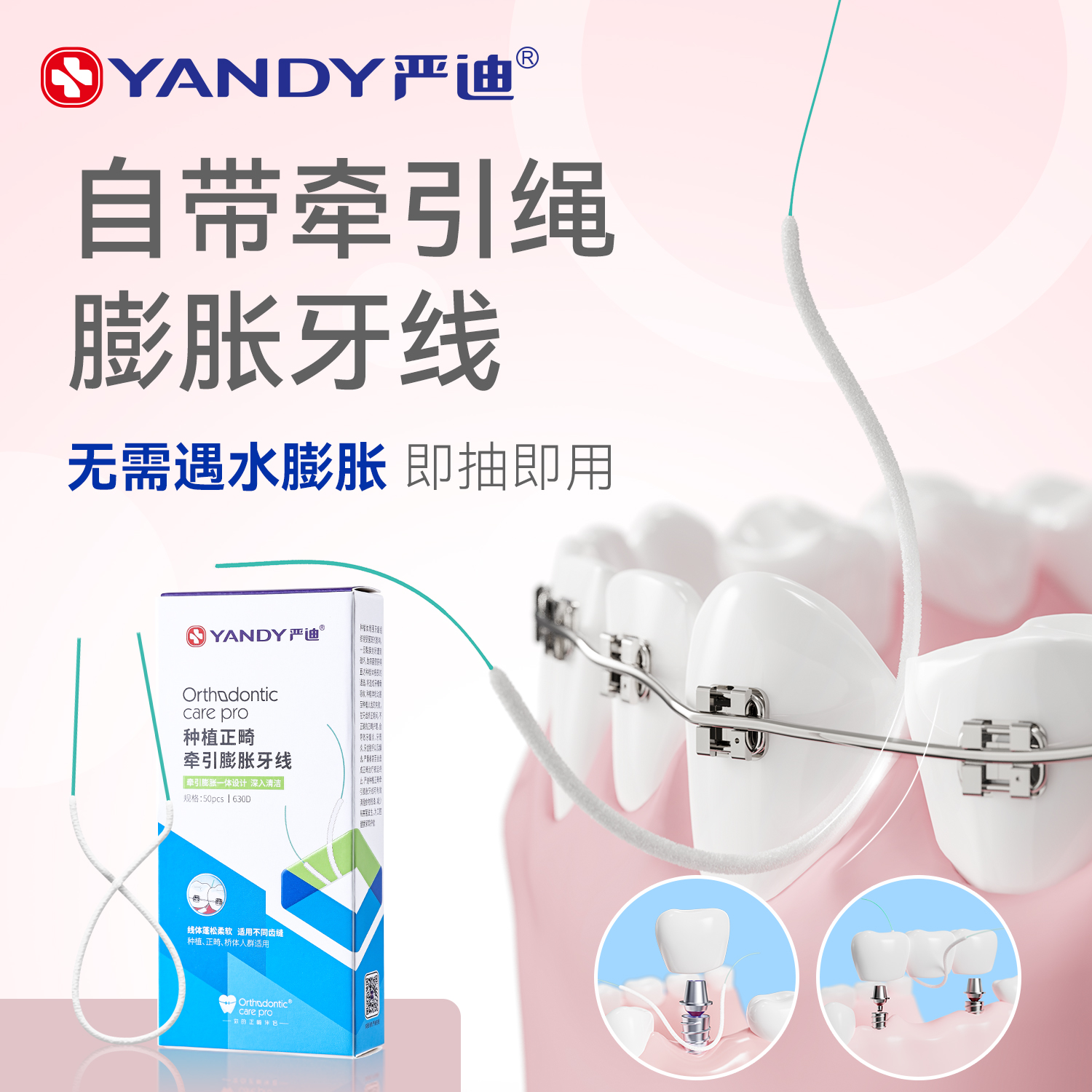 严迪正畸膨胀牙线牵引器矫正专用