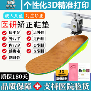 3D定制扁平足矫正打印鞋垫足外翻内八字副舟骨足弓成人儿童xo型腿