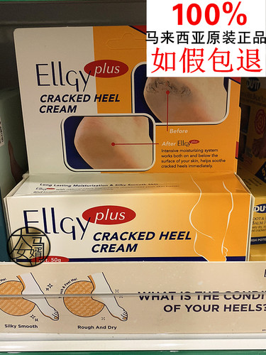 包邮马来西亚优姿龟裂膏