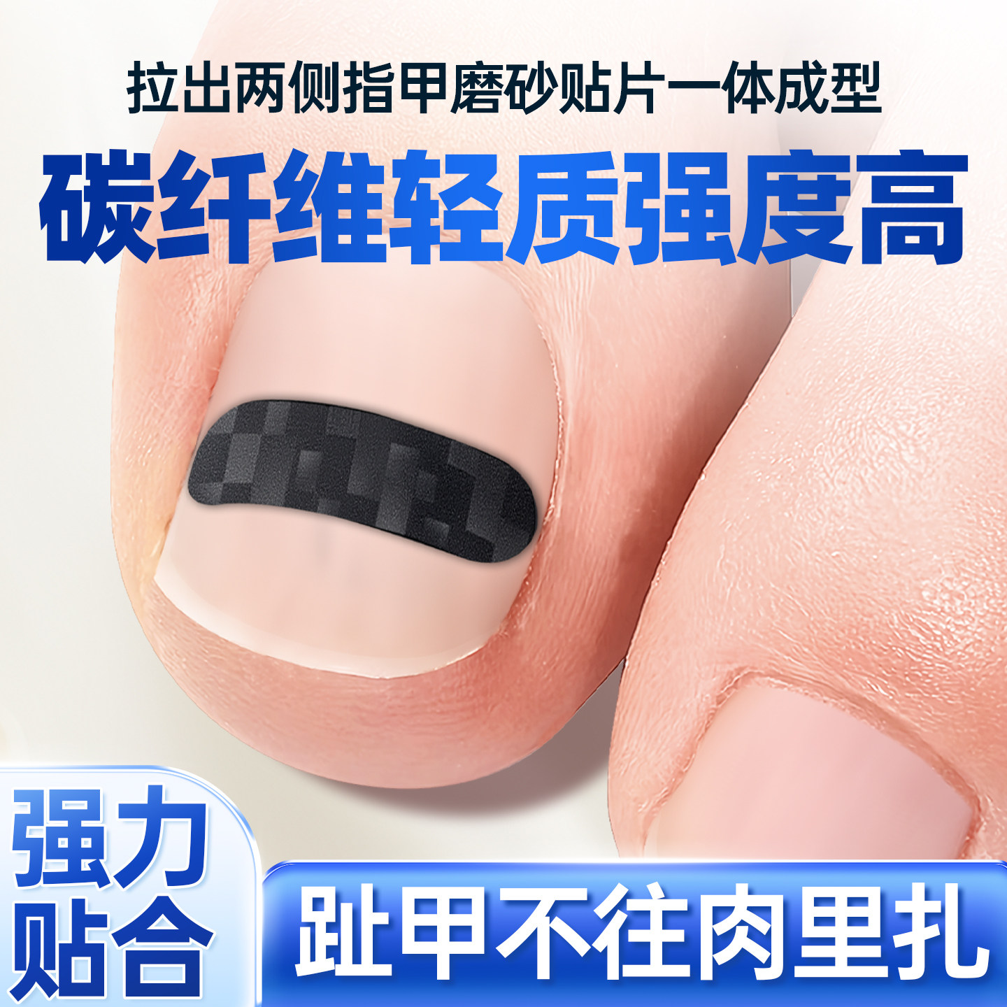 正甲贴甲沟炎矫正器炎脚趾甲嵌甲
