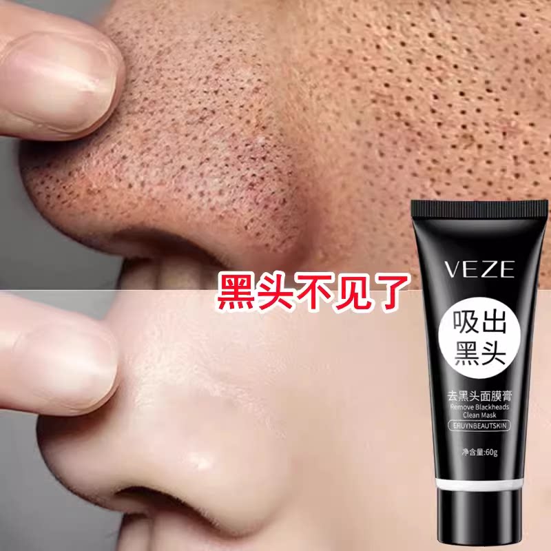 去黑头粉刺收缩毛孔深层清洁撕拉面膜神器黑头贴吸出鼻贴强力膏