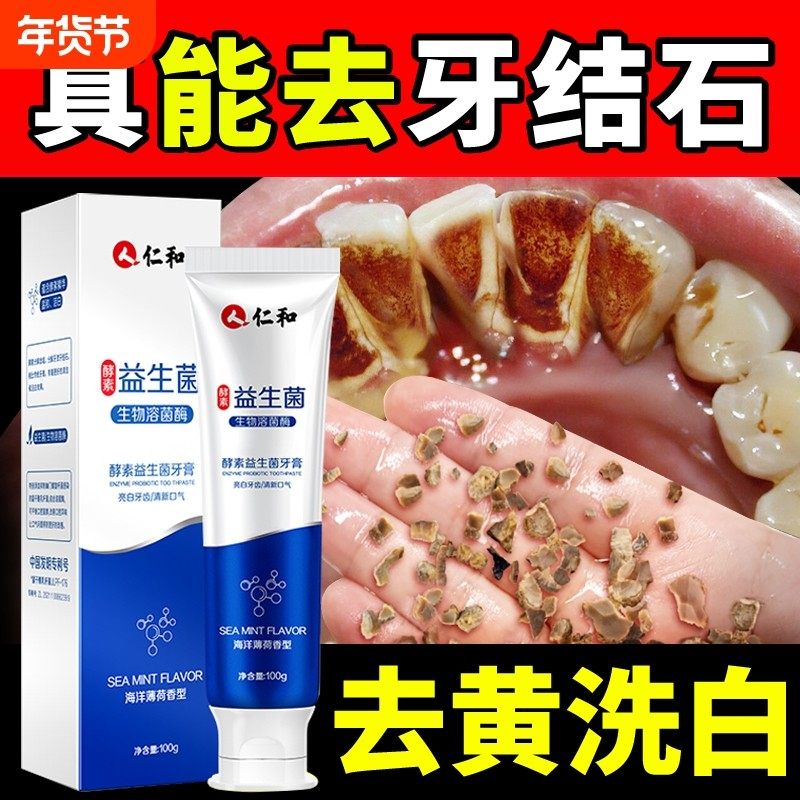 牙膏去黄益生菌正品速效洗白去除牙结石垢非男士专用口臭,洗护清洁剂/卫生巾/纸/香薰,牙膏,淘宝优惠券,粉丝福利购,淘宝优惠卷