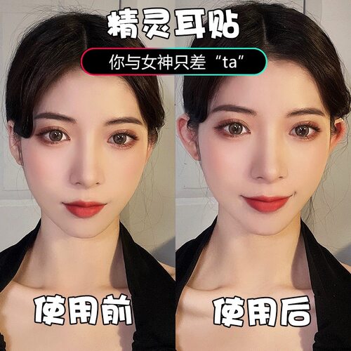 精灵耳贴贴面耳变招风耳立耳贴固定贴耳夹拍照矫正支撑器硅胶