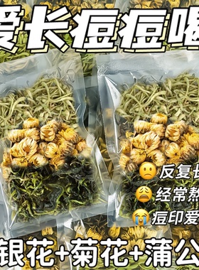 金银花菊花蒲公英茶茶叶清排热解降毒火去男女泡水饮品痘花茶包