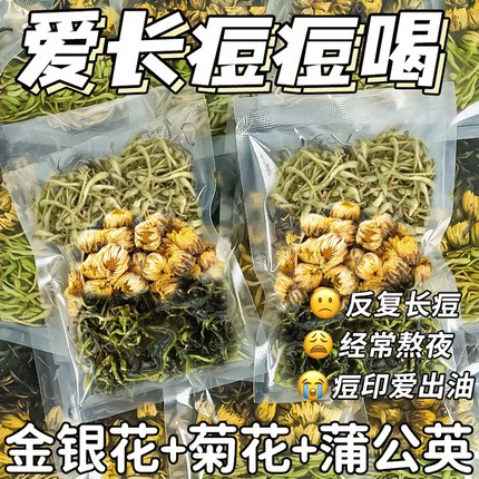 金银花菊花蒲公英茶胎菊清解热降毒火去男女生泡水饮品祛痘花茶包