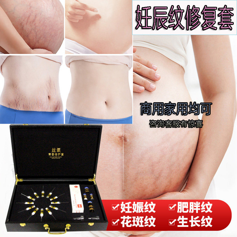 [美容院榜首其它美容,美体工具]产后修复丝氧祛妊娠纹大腿肥胖纹生长纹月销量0件仅售9元