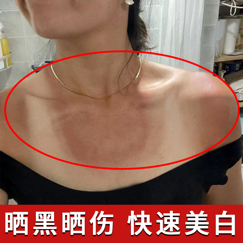 晒黑了皮肤晒伤晒后军训修复黑怎么快速变白霜儿童男士美白乳面部