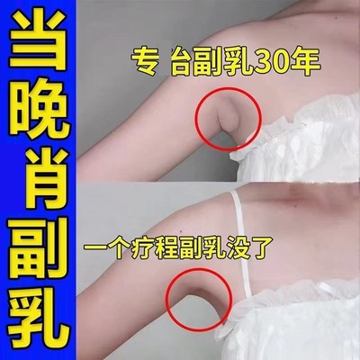 副乳消除贴淋巴结消贴耳后肿大收副乳去结节腋下颈部贴膏消除神器