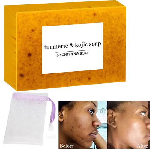 Turmeric Kojic Acid Glow Soap Dark Spot Acne Removal Even Sk