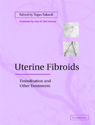 【预售】Uterine Fibroids: Embolization and Other Treatments