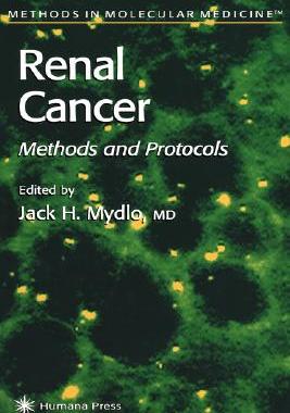【预售】Renal Cancer: Methods and Protocols