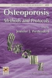 【预售】Osteoporosis: Methods and Protocols [With CDROM]