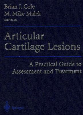 【预订】Articular Cartilage Lesions: A Practical Guide to