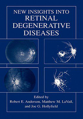 美国库房发货，通常付款后5-8周到货！