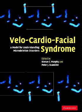 【预售】Velo-Cardio-Facial Syndrome: A Model for