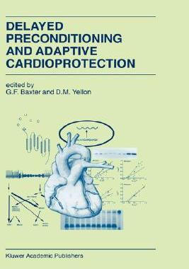 【预售】Delayed Preconditioning and Adaptive