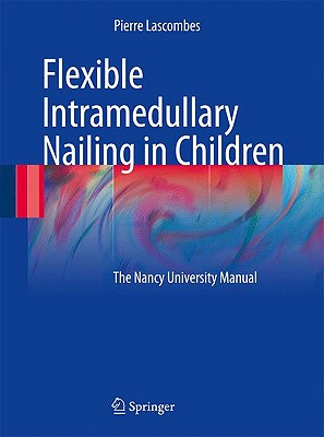 【预售】Flexible Intramedullary Nailing in Children: The