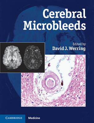 【预售】Cerebral Microbleeds: Pathophysiology to Clinical