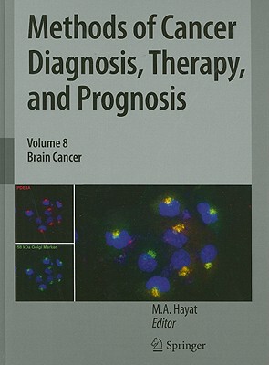【预售】Methods of Cancer Diagnosis, Therapy, and Prognosis