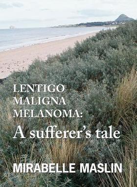 【预售】Lentigo Maligna Melanoma: A Sufferer's Tale