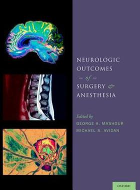 【预售】Neurologic Outcomes of Surgery and Anesthesia