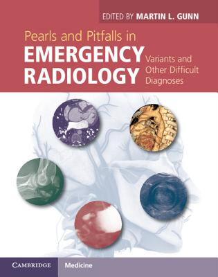 【预售】Pearls and Pitfalls in Emergency Radiology: Variants