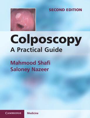 【预售】Colposcopy: A Practical Guide. Mahmood I. Shafi and