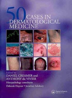 【预售】50 Cases in Dermatological Medicine