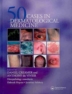 【预售】50 Cases in Dermatological Medicine