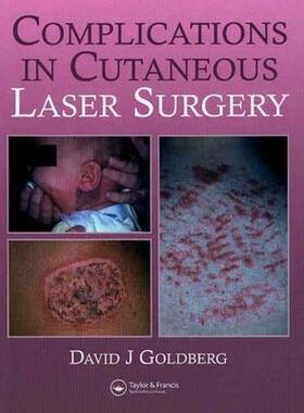 【预售】Complications in Laser Cutaneous Surgery
