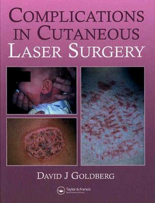 【预售】Complications in Laser Cutaneous Surgery