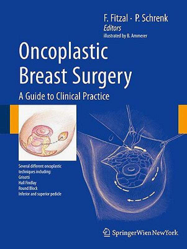 【预售】Oncoplastic Breast Surgery: A Guide to Clinical