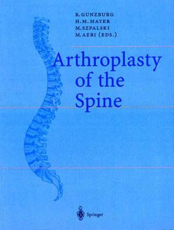 【预售】Arthroplasty of the Spine