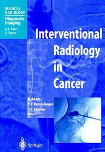 【预售】Interventional Radiology in Cancer