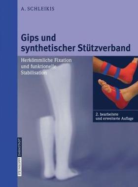 【预售】Gips Und Synthetischer St Tzverband: Herk Mmliche