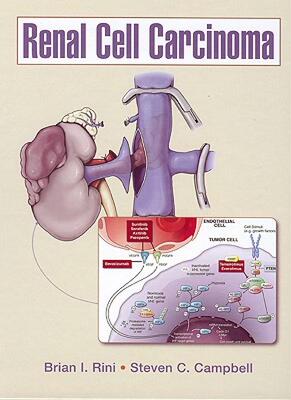 【预售】Renal Cell Carcinoma