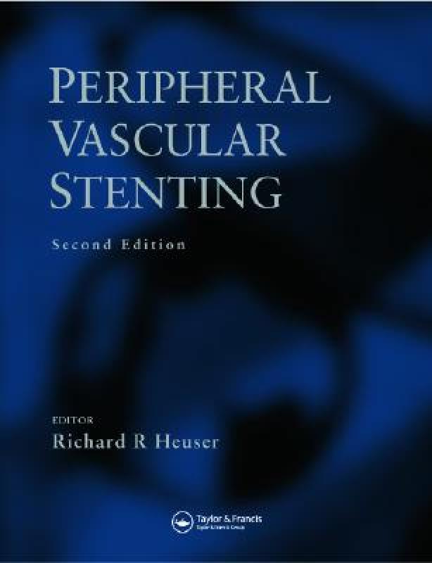 【预售】Peripheral Vascular Stenting, Second Edition