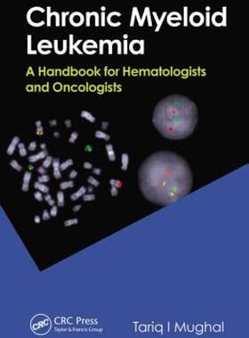【预售】Chronic Myeloid Leukemia: A Handbook for Oncologists