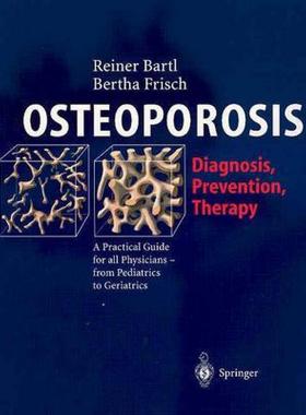 【预售】Osteoporose-Manual: Diagnostik, Pravention Und