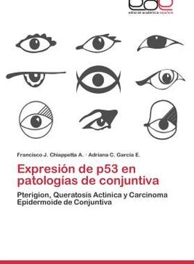 【预售】Expresion de P53 En Patologias de Conjuntiva