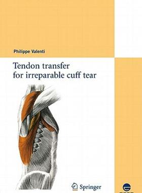 【预售】Tendon Transfer for Irreparable Cuff Tear