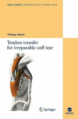 【预售】Tendon Transfer for Irreparable Cuff Tear