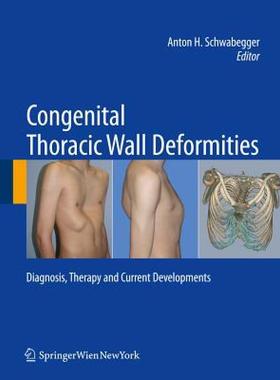 【预售】Congenital Thoracic Wall Deformities: Diagnosis
