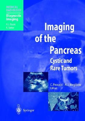 【预售】Imaging of the Pancreas: Cystic and Rare Tumors
