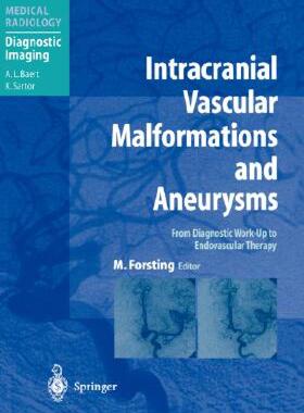 【预售】Intracranial Vascular Malformations and Aneurysms: