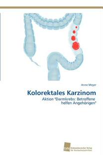 【预售】Kolorektales Karzinom