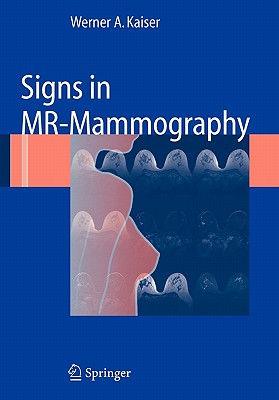 【预售】Signs in MR-Mammography