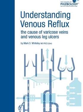 【预售】Understanding Venous Reflux the Cause of Varicose